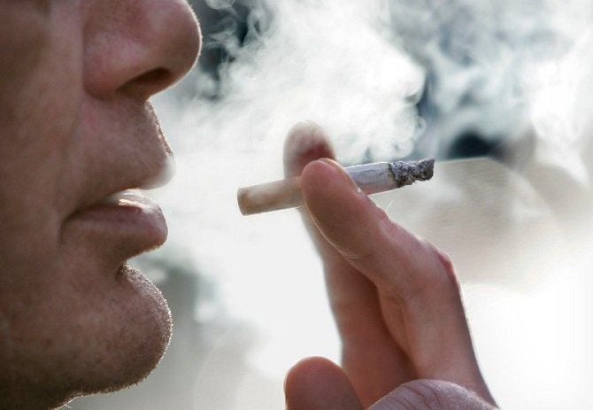 Vàng răng do hút thuốc lá: Tác hại và giải pháp cải thiện Vàng răng do hút thuốc lá: Tác hại và giải pháp cải thiện