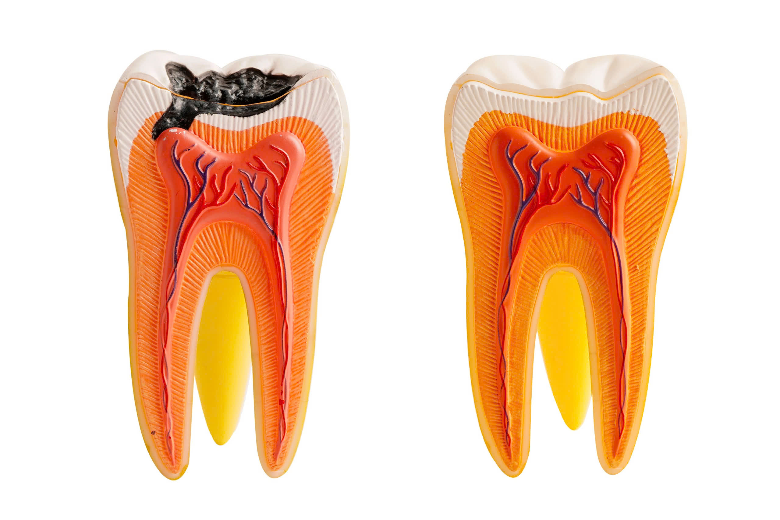 Vàng răng do thói quen uống trà: Ảnh hưởng và lời khuyên nha khoa Vàng răng do thói quen uống trà: Ảnh hưởng và lời khuyên nha khoa